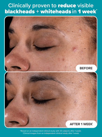 2% BHA Liquid Exfoliant