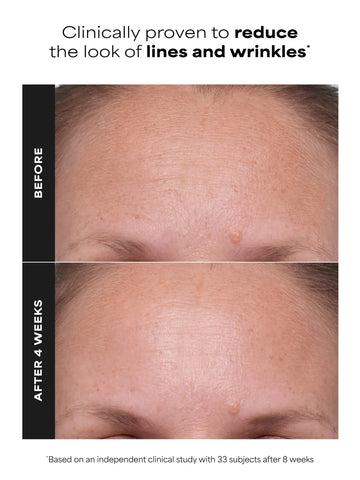 1% Retinol Treatment